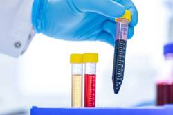 CRISPR-technologie voor behandeling van RDEB
