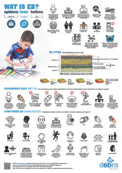 Wat is EB? (infografieken)